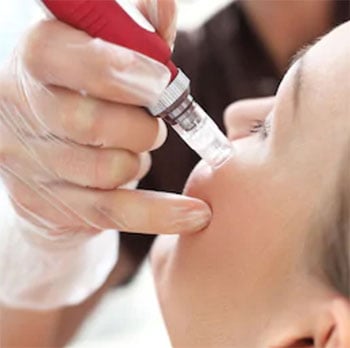 Preenchimento com Ácido hialurônico em Pó